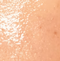 Oily Skin